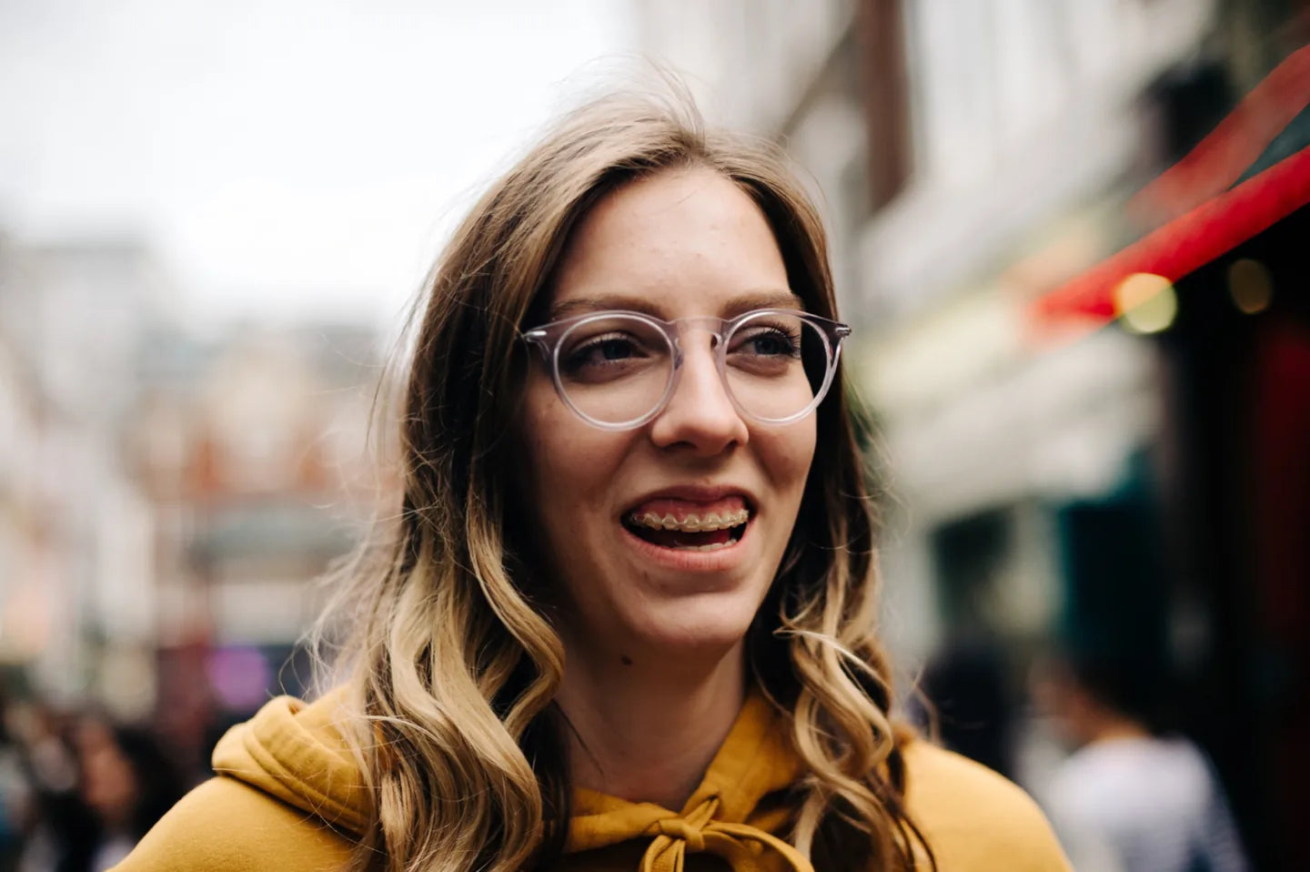 צחצוח שיניים עם גשר – המדריך המלא לניקוי מושלם בזמן יישור