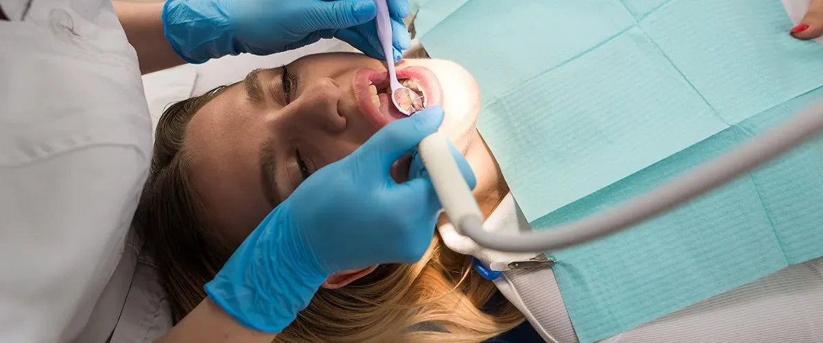 אבנית בשיניים – מניעה, זיהוי והסרה | המדריך המלא